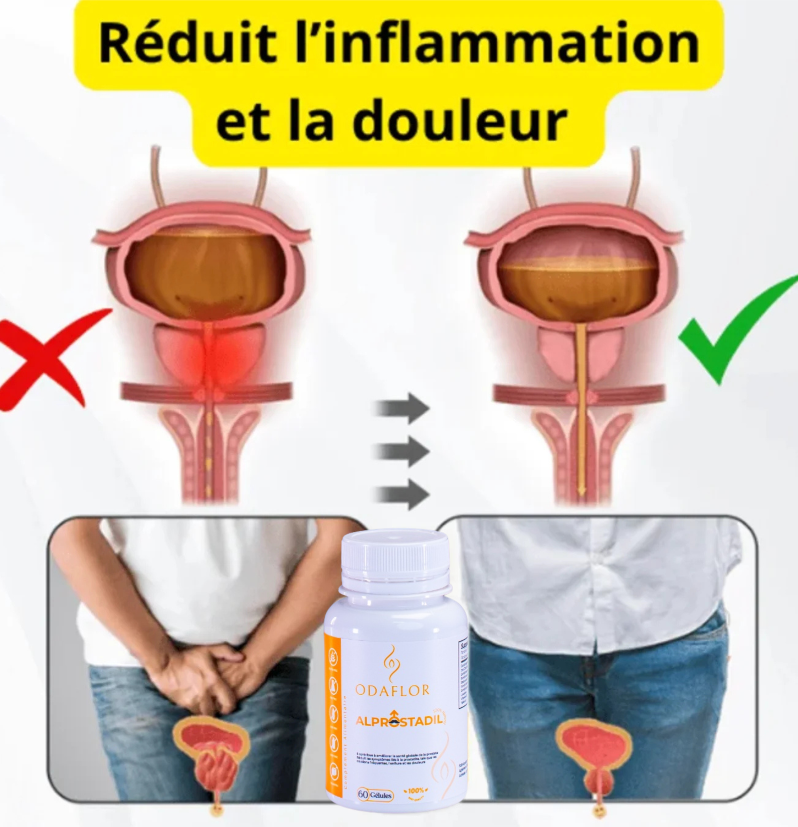 Produit ALPROSTADIL ODAFLOR